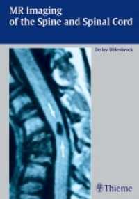 MR Imaging of the Spine and Spinal Cord （2004. IX, 518 p. w. 1305 figs. 24,5 cm）