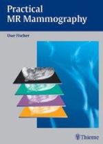 Practical MR Mammography （2004. XI, 211 p. w. 398 ill. (some col.). 28 cm）