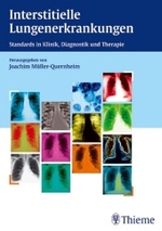Interstitielle Lungenerkrankungen : Standards in Klinik, Diagnostik und Therapie （2003. VIII, 160 S. m. 50 z. Tl. farb. Abb. 24 cm）