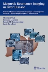 Magnetic Resonance Imaging in Liver Disease : Technical Approach, Diagnostic Imaging of Liver Neoplasms, Focus on a New Superparamagnetic Contrast Agent （2003. XII, VIII, 260 p. w. 681 figs. 24 cm）