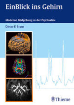 EinBlick ins Gehirn : Moderne Bildgebung in der Psychiatrie （2004. X, 118 S. m. 71 meist farb. Abb. 24,5 cm）