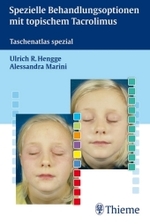 Spezielle Behandlungsoptionen mit topischem Tacrolimus : Taschenatlas spezial （2007. VI, 48 S. m. 20 Abb. 19 cm）