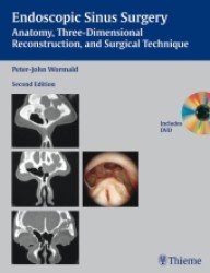 内視鏡下副鼻腔外科（第２版）<br>Endoscopic Sinus Surgery : Anatomy, Three-Dimensional Reconstruction and Surgical Technique （2ND）