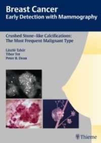 Crushed Stone-like Calcifications : The Most Frequent Malignant Type (Breast Cancer - Early Detection with Mammography)