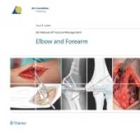 ＡＯ法骨折治療：肘と前腕<br>AO Manual of Fracture Management: Elbow and Forearm