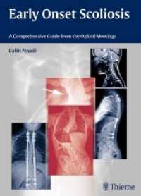 Early Onset Scoliosis : A Comprehensive Guide from the Oxford Meetings （2015. 372 S. 210 Abb. 2700 mm）