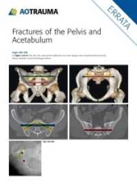骨盤・寛骨臼骨折（第４版・全２巻）<br>Fractures of the Pelvis and Acetabulum (AO) : Principles and Methods of Management （4th edition. 2015. 1000 S. 734 Abb. 280 mm）