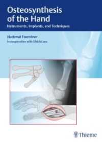 Osteosynthesis of the Hand : Instruments, Implants, and Techniques （2016. 200 p. 775 Abb. 270 mm）