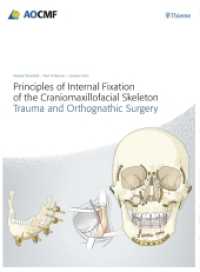 Principles of Internal Fixation of the Craniomaxillofacial Skeleton : Trauma and Orthognathic Surgery