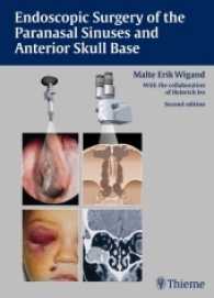 内視鏡下副鼻腔／前頭蓋底外科（第２版）<br>Endoscopic Surgery of the Paranasal Sinuses and Anterior Skull Base : Forew. by David W. Kennedy （2ND）