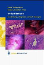 Endometriose : Entstehung, Diagnose, Verlauf Und Therapie
