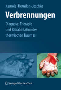 Verbrennungen : Diagnose, Therapie und Rehabilitation des thermischen Traumas （2008. 200 S. m. 50 Farbabb. 242 mm）