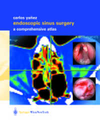 Endoscopic Sinus Surgery : A Comprehensive Atlas （2003. 150 p.）