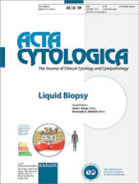 Liquid Biopsy : Special Topic Issue: Acta Cytologica 2019, Vol. 63, No. 6 （2019. 74 S. 8 fig., 6 in color, 9 tab. 28 cm）