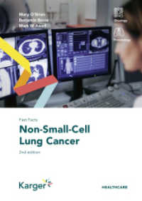 Fast Facts: Non-Small-Cell Lung Cancer （2. Aufl. 2022. 146 S. 9 fig., 7 in color, 22 tab. 210 mm）