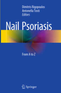 Nail Psoriasis : From a to Z