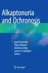 Alkaptonuria and Ochronosis