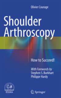 Shoulder Arthroscopy : How to Succeed!