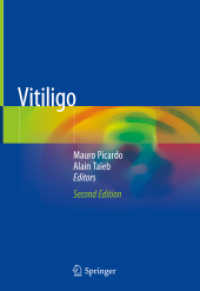 Vitiligo （2ND）