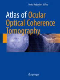 Atlas of Ocular Optical Coherence Tomography （1st ed. 2018. 2018. ix, 483 S. IX, 483 p. 619 illus., 571 illus. in co）
