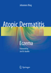 Atopic Dermatitis : Eczema