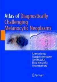 Atlas of Diagnostically Challenging Melanocytic Neoplasms