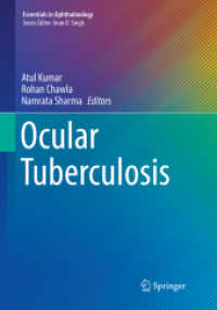 Ocular Tuberculosis (Essentials in Ophthalmology)