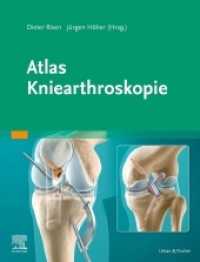 Atlas Kniearthroskopie : Mit Zugang zur Medizinwelt （2020. XII, 188 S. 360 Farbabb. 270 mm）
