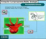 Prostatakarzinom (Computer-lernprogramm-reihe Urologie)