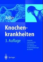 Knochenkrankheiten : Diagnostik Makroskopischer, Histologischer Und Radiologischer Strukturveranderungen Des Skeletts （3RD）