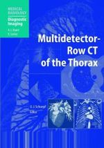 Multidetector-Row CT of the Thorax : Forew. by M. F. Reiser (Medical Radiology, Diagnostic Imaging) （2006. XV, 480 p. w. 349 figs. 27 cm）