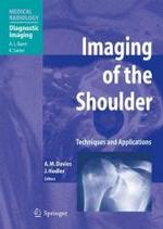 肩の画像診断<br>Imaging of the Shoulder : Techniques and Applications. Forew. by A. L. Baert (Medical Radiology, Diagnostic Imaging) （2006. X, 331 p. w. 299 figs. (some col.) 27 cm）
