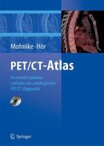 PET/CT-Atlas, m. CD-ROM : Ein interdisziplinärer Leitfaden der onkologischen PET/CT-Diagnostik （2006. X, 515 S. m. 579 Farb- u. 88 SW-Abb. 27,5 cm）
