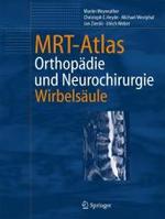Mrt-Atlas : Orthopadie Und Neurochirurgie. Wirbelsaule