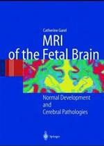 MRI of the Fetal Brain : Normal Development and Cerebral Pathologies （2004. XVI, 267 p. w. numerous figs. (some col.)）