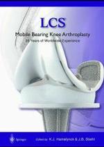 Lcs Mobile Bearing Knee Arthroplasty : A 25 Years Worldwide Review