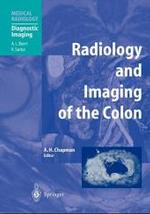 結腸の放射線学および画像<br>Radiology and Imaging of the Colon : Forew. by A. L. Baert (Medical Radiology, Diagnostic Imaging) （2004. XII, 324 p. w. 226 b&w and 77 col. figs. 28 cm）