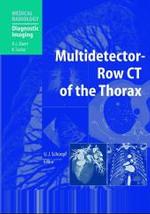 Multidetector-Row CT of the Thorax (Medical Radiology, Diagnostic Imaging) （2004. XV, 480 p. w. 349 figs. in 641 sep. ills. (100 col.). 27,5 cm）