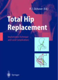 Total Hip Replacement : Implantation Techniques and Local Complications （2003. 220 p. w. 337 figs. (numerous col.)）