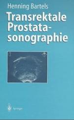 Transrektale Prostatasonographie