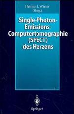 Single-Photon-Emissions-Computertomographie (Spect) Des Herzens