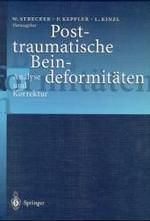 Posttraumatische Beindeformitaten : Analyse Und Korrektur