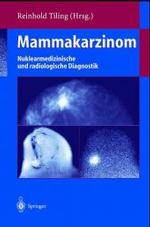 Mammakarzinom : Nuklearmedizinische Und Radiologische Diagnostik