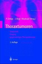 Thoraxtumoren : Diagnostik Staging Gegenwartiges Therapiekonzept （2ND）