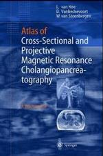 Atlas of Cross-Sectional and Projective Magnetic Resonance Cholangiopancreatography : A Teaching File