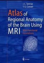 ＭＲＩ画像による脳局所解剖学アトラス<br>Atlas of Regional Anatomy of the Brain Using MRI : With Functional Correlations. Foreword by Hans O. Lüders （2000. XVI, 330 p. w. 458 figs. 28 cm）
