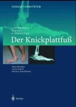 Fussdeformitaten : Der Knickplattfua