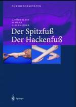 Fussdeformitaten : Der Spitzfu / Der Hackenfu
