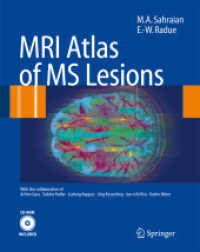 MRI Atlas of Lesions in Multiple Sclerosis