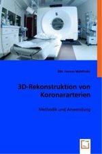 3D-Rekonstruktion von Koronararterien : Methodik und Anwendung （2008. 248 S. 220 mm）